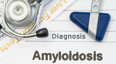 Amyloidosis – Its symptoms, causes, diagnoses, and treatments