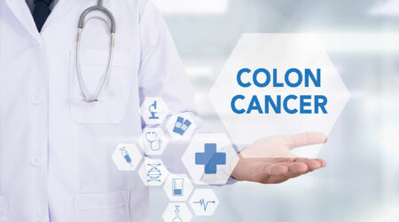 Colon cancer – Its causes, symptoms, and stages