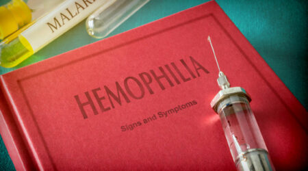 Hemophilia – Its types, causes, symptoms, and management