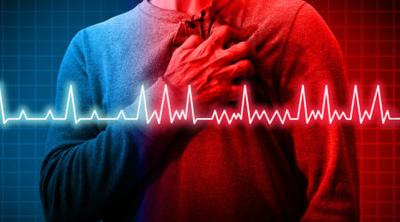 What is atrial fibrillation