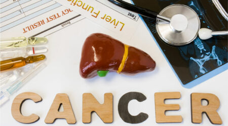 4 essential things to know about liver cancer