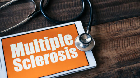Multiple sclerosis – Causes, symptoms, and how it can be managed