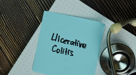 A comprehensive guide to ulcerative colitis