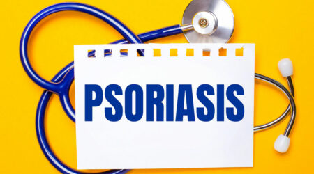 A comprehensive guide to plaque psoriasis