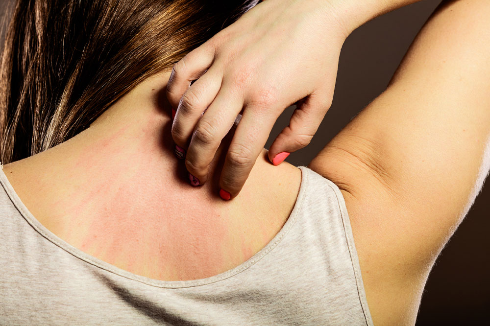 Important factors to know about eczema