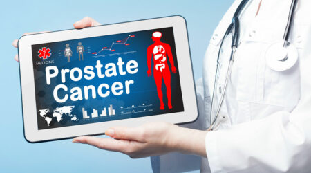 Prostate cancer – Its causes, symptoms, and management