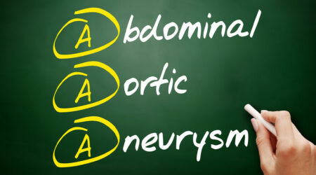 Abdominal aortic aneurysm – Diagnosis, remedial measures, and more