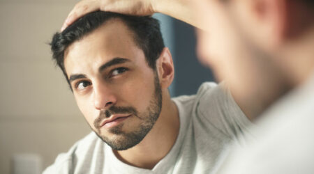 Alopecia areata – Causes, symptoms, and management techniques