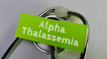 Alpha thalassemia – Types, causes, symptoms, and more
