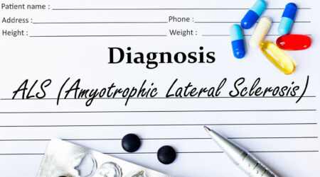 Amyotrophic lateral sclerosis – Signs, causes, and more