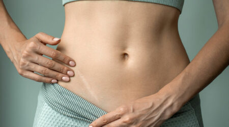 Everything about scar tissue, its types, and health impact