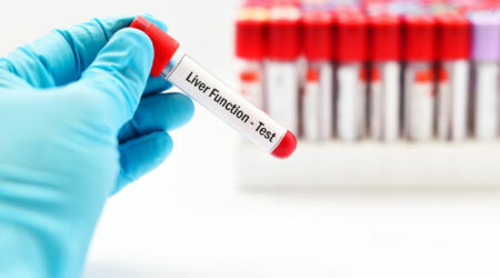 Liver function tests – Types, procedure, and results