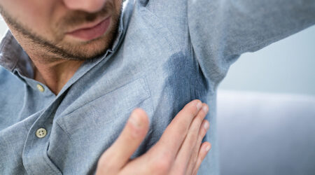 Symptoms, types, and management options of hyperhidrosis