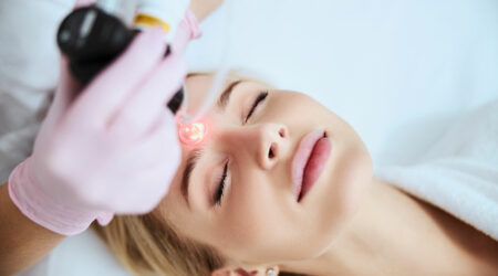 Things to know before undergoing laser resurfacing for acne