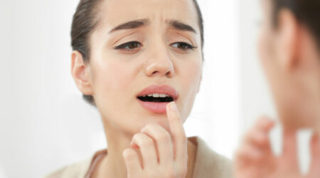 What are cold sores and how to manage them