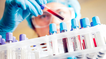 What is the alpha-fetoprotein test and its importance