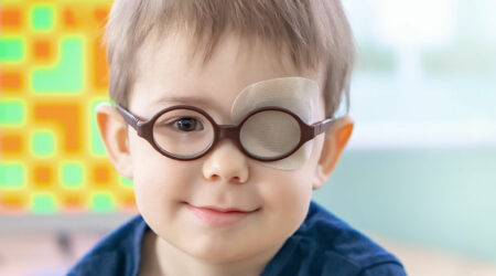 10 facts to know about lazy eye