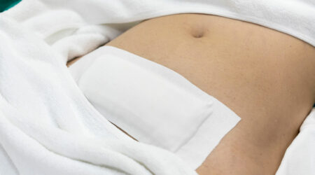 Myomectomy – Types and risks associated with it