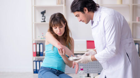 How to identify and manage second-degree burns