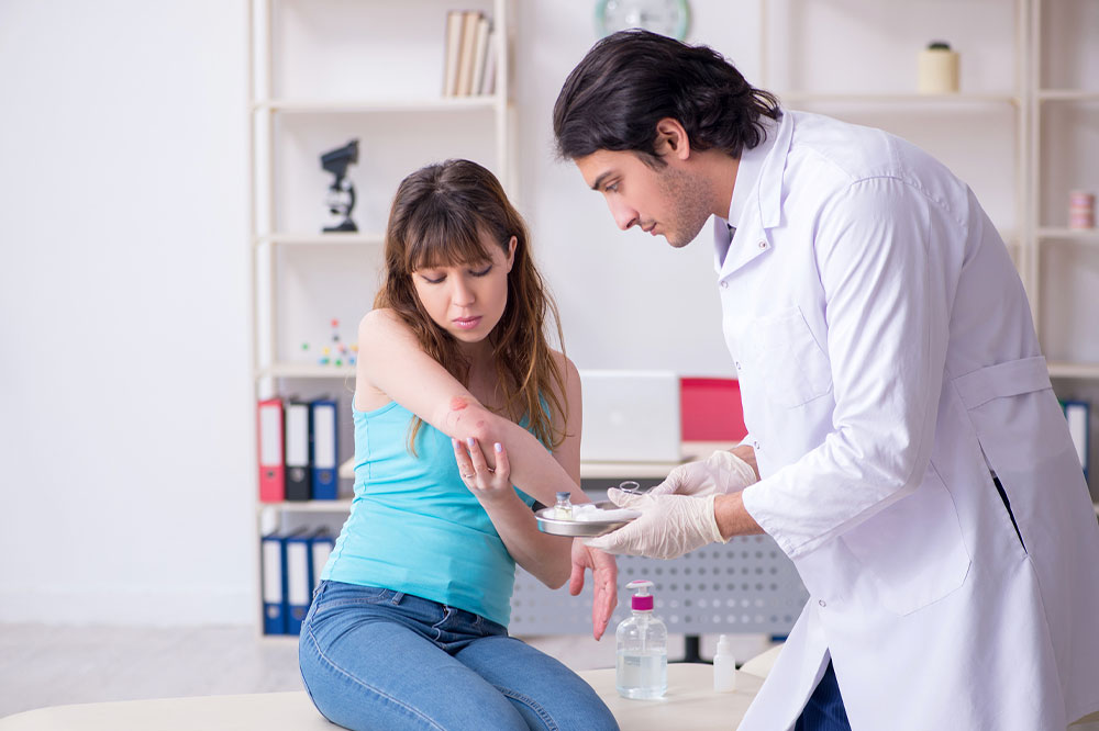 How to identify and manage second-degree burns