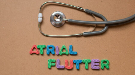 Atrial flutter – Types, signs, causes, and management