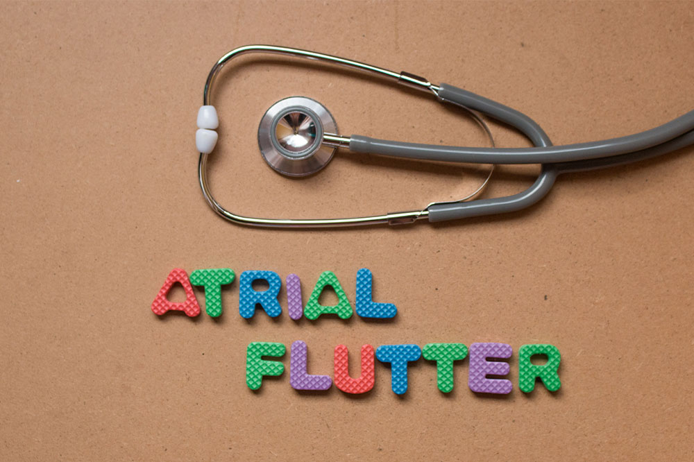 Atrial flutter – Types, signs, causes, and management