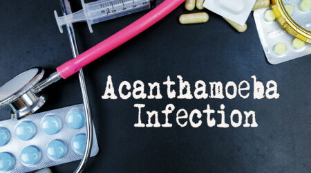 Acanthamoeba infection – Symptoms, causes, and management