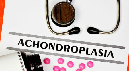 Achondroplasia – Causes, signs, and management