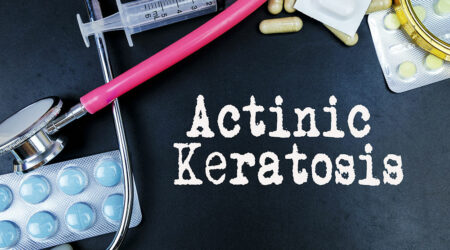Actinic keratosis – Signs, causes, diagnosis, and management