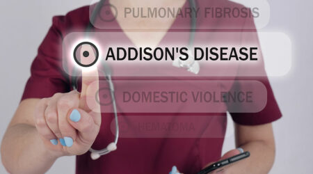Addisons disease – Things to know about the condition