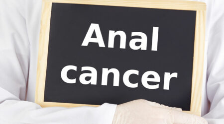 Anal cancer – Diagnosis, causes, and more