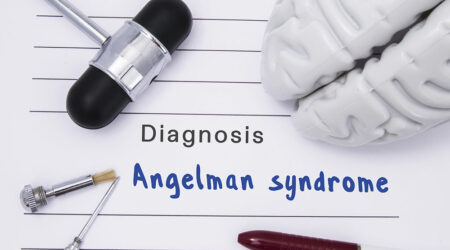Angelman syndrome – Signs, causes, diagnosis, and management