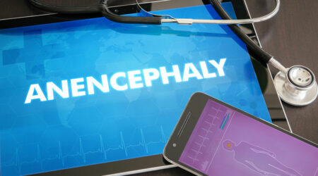 Anencephaly – Its dangers and managing the risk factors