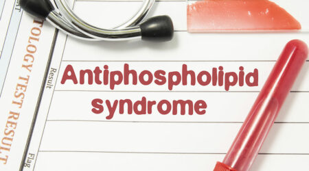 Antiphospholipid syndrome – Symptoms, causes, and management