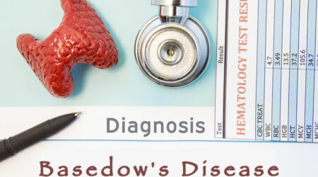Basedow’s disease – Causes, symptoms, diagnosis, and management