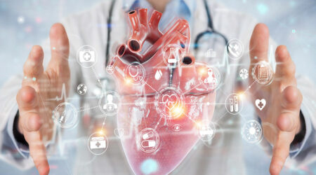 Everything to know about the myocardial perfusion scan