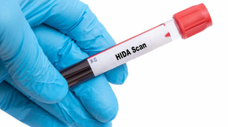 HIDA scan – Things to know about the procedure