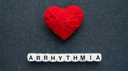 How to identify and manage arrhythmia