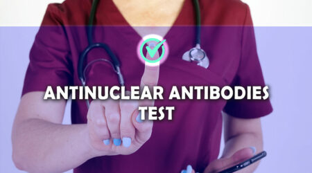 Key features of the antinuclear antibody test