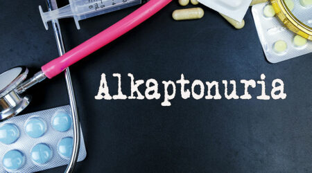 Learn about alkaptonuria – a rare metabolic disorder