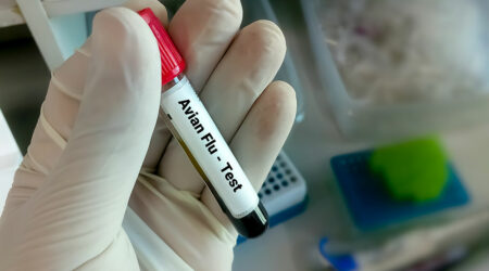 Symptoms and diagnosis for avian flu