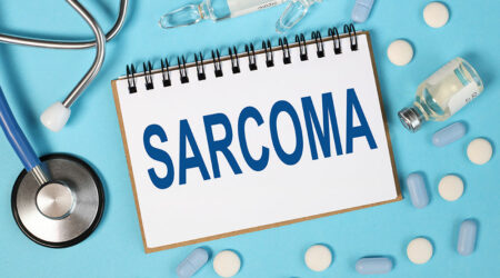 Synovial sarcoma – Symptoms, causes, and management